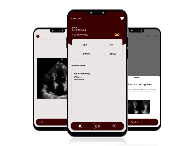 Cardio Intel Mobile App