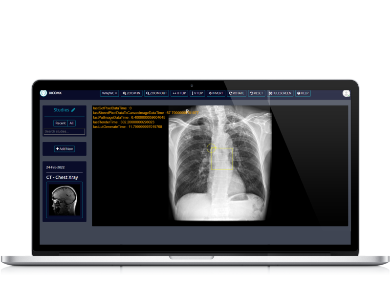 DICOM-X Web App